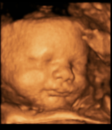 4D Baby Scans Marlow, Early Pregnancy Scans, Marlow Scan Clinic